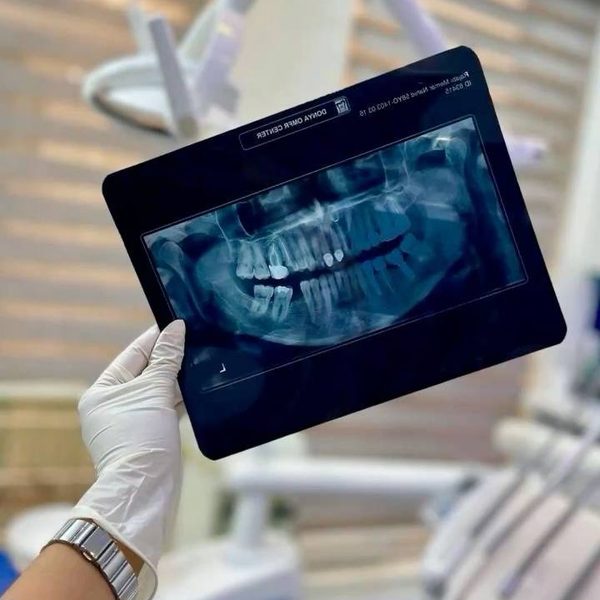 A panoramic X-ray held up in the treatment room